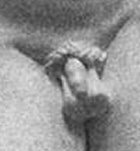 Risen Christ's penis, by Michelangelo