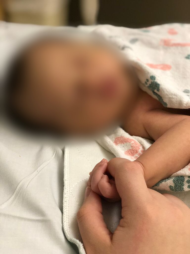 baby after botched genital cutting