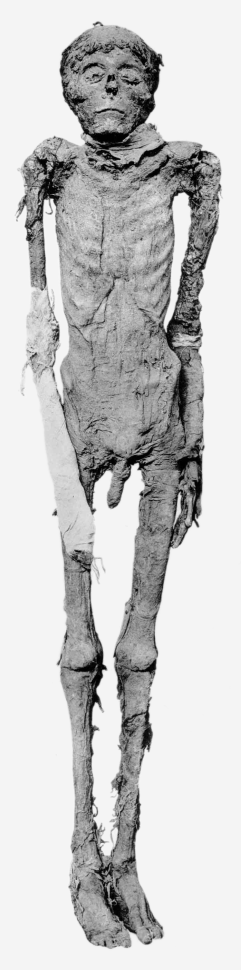 Mummy of King Ahmose I