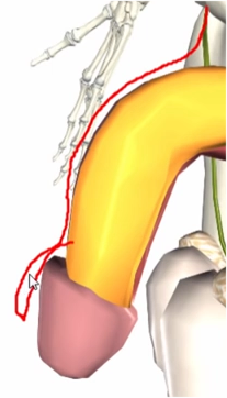 crude doodle in animated-anatomy video